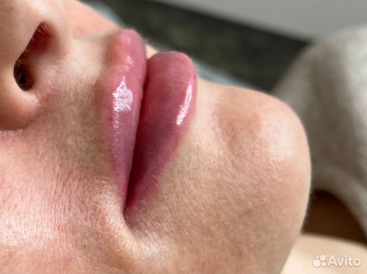 Косметолог. Губы