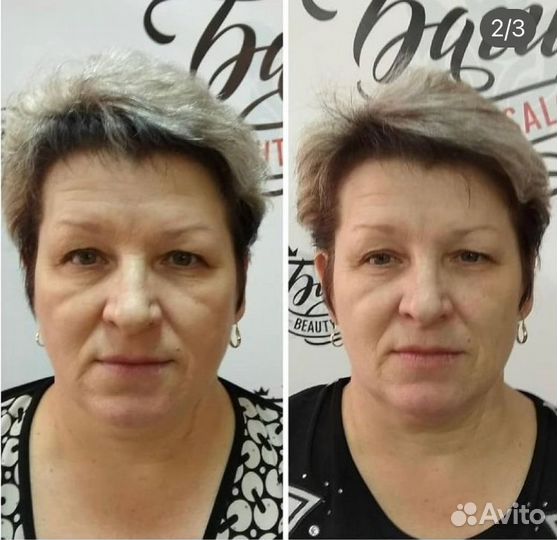 Массаж лица