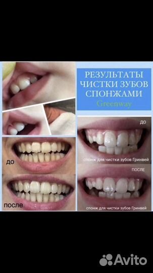 Спонжи для чистки зубов