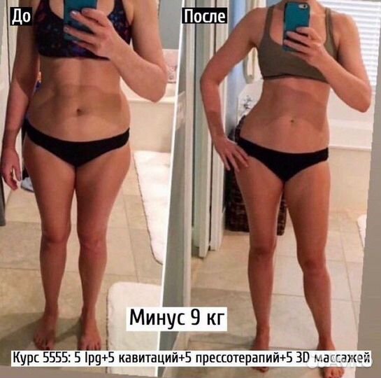 Аппаратный массаж (LPG, 3d и др.)