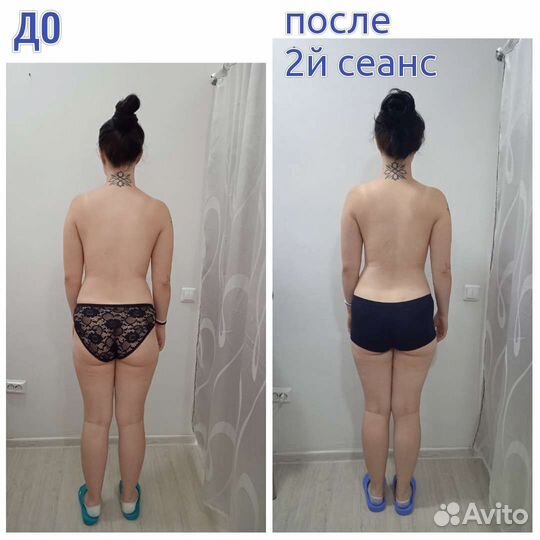 Лечебный массаж Остеопластика по метод Виталия Ким