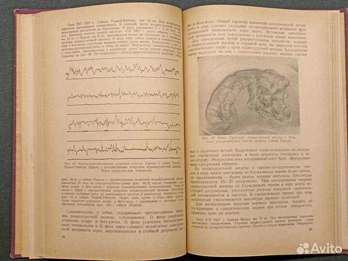 Электроэнцефалография в хирургической практике. Дв