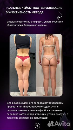 Обучение Массаж