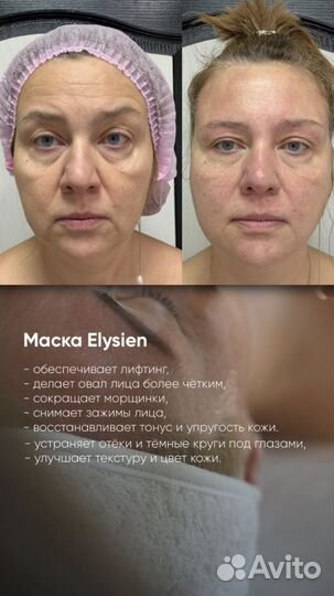 Skindex Мышечна Лифтинг маска Elysien Multy