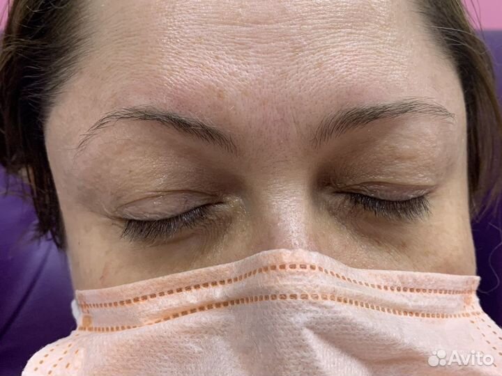 Брови и ресницы