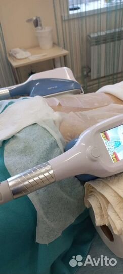 Криолиполиз/Локальное удаление жира