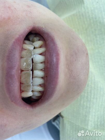 Проф гигиена и другое