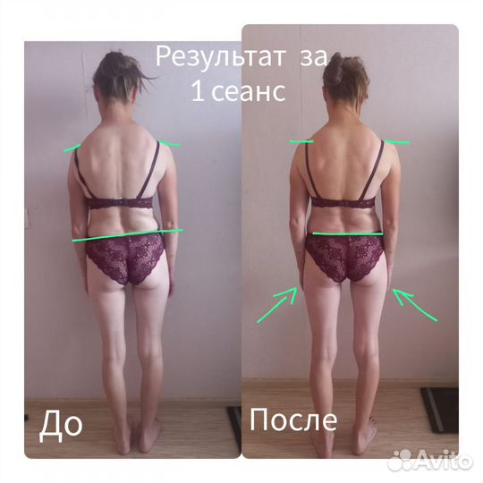 Профессиональный оздоровительный массаж