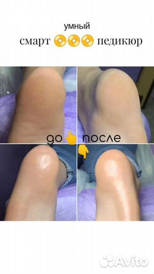 Детский маникюр