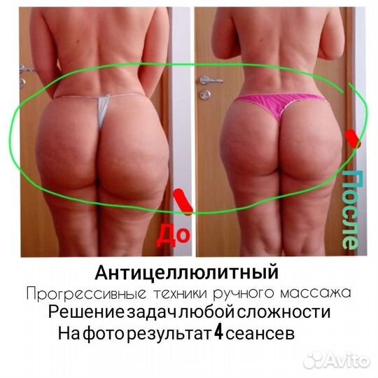 Массаж спины, Ног, Рук, Шеи, Лица. Убрать Боль