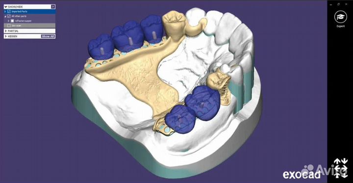 Exocad 8349 (3.1) последняя версия