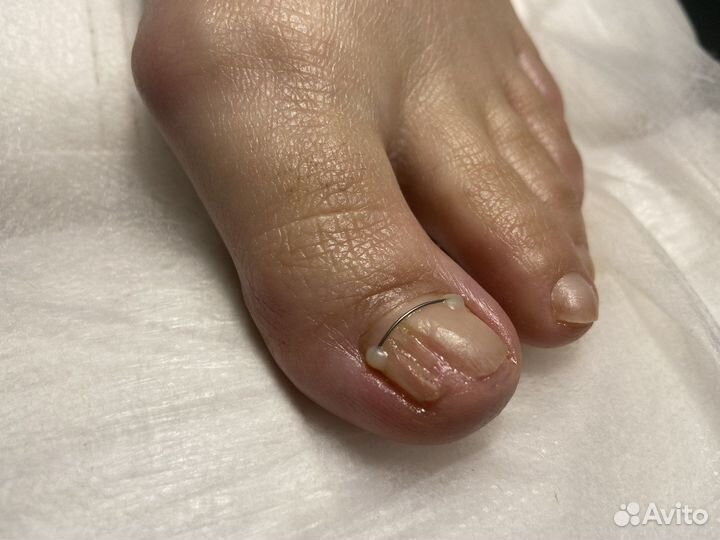 Услуги подолога