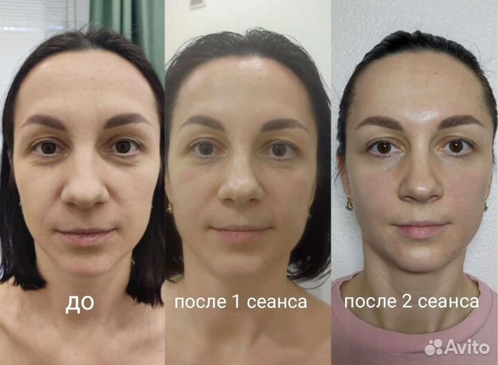 Массаж лица и тела