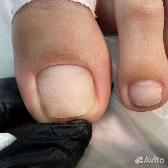 Смарт педикюр