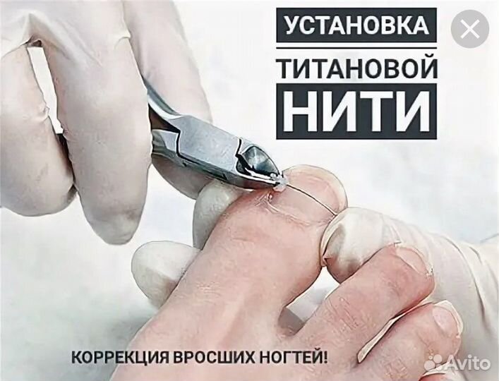 Титановые ногти технология нанесения и снятия