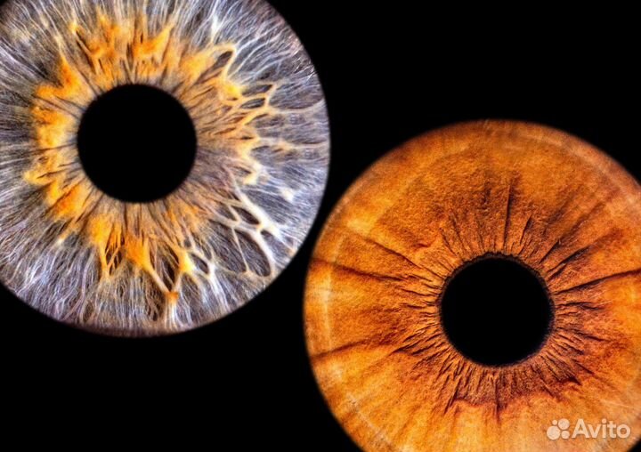 Фото радужки глаза