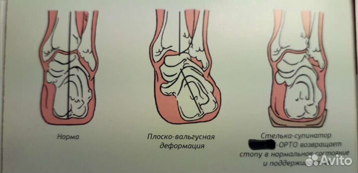 Индивидуальный пошив и реставрация обуви