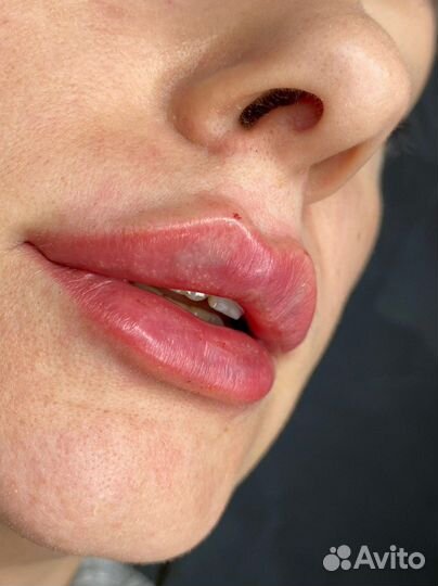 Уход за лицом