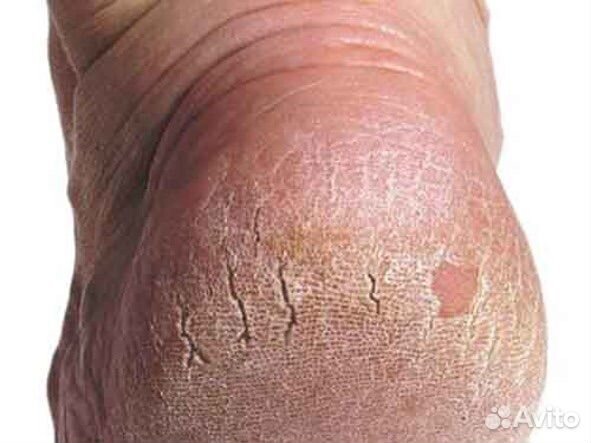 Модель на педикюр