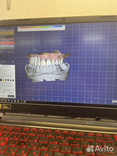 Зубной техник