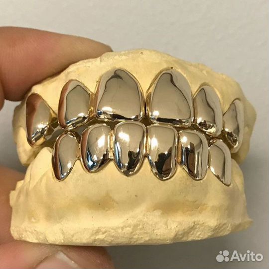 Зубное золото