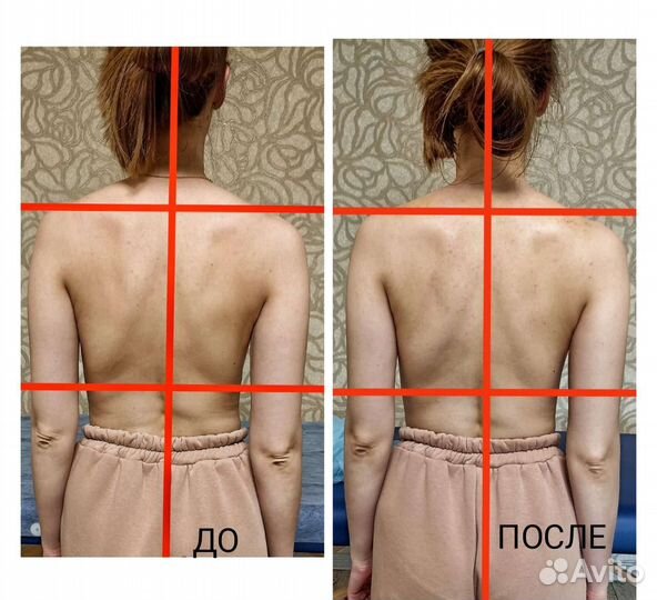 Лечебный массаж, антицеллюлитный массаж