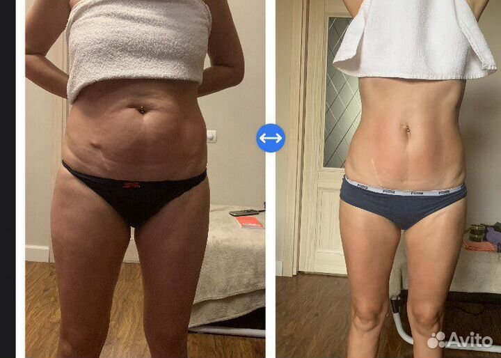 Антицеллюлитный массаж