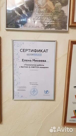 Удаление татуажа лазером