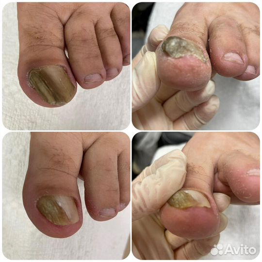 Подолог. Педикюр. Маникюр