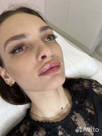 Увеличение губ