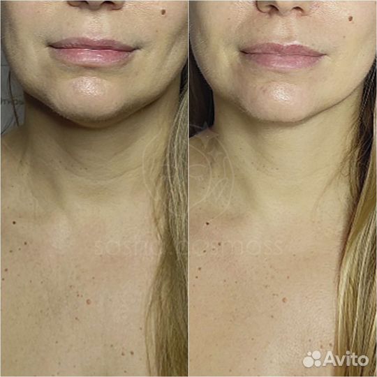 Массаж и чистка лица