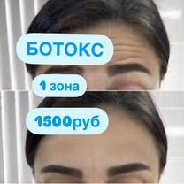 Ботокс/ботулинотерапия