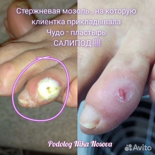 Услуги подолога