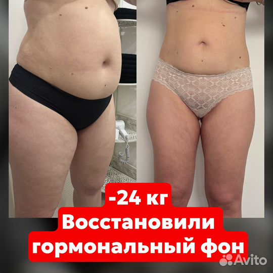 Антицелюллитный массаж LPG Похудение