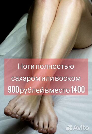 Депиляция