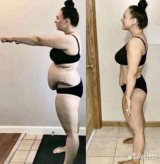 Плоский живот - размер за 1 процедуру. Криолиполиз