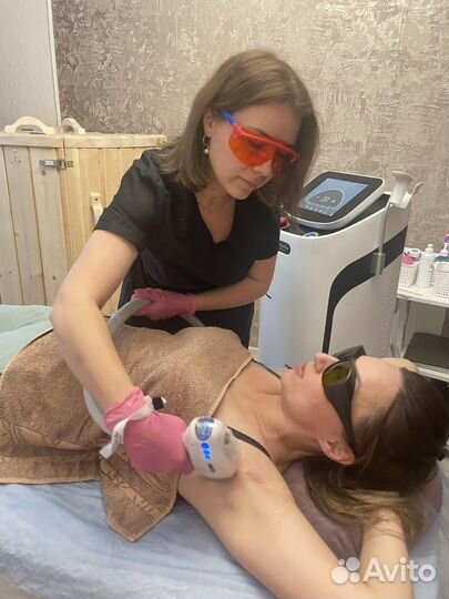 Лазерная эпиляция