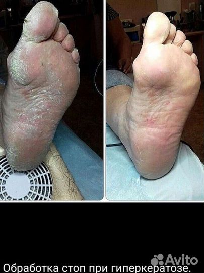 Подолог. Косметолог. Парикмахер. Маникюр Б. Козино