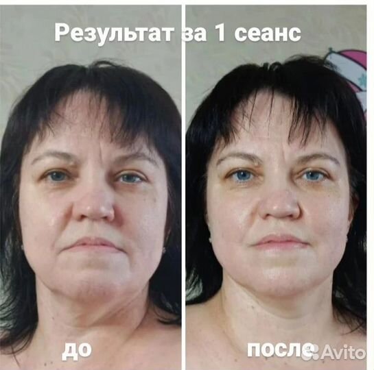 Массаж лица. Массаж для женщин