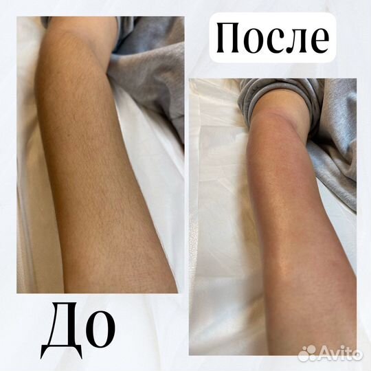 Депиляция воском шугаринг