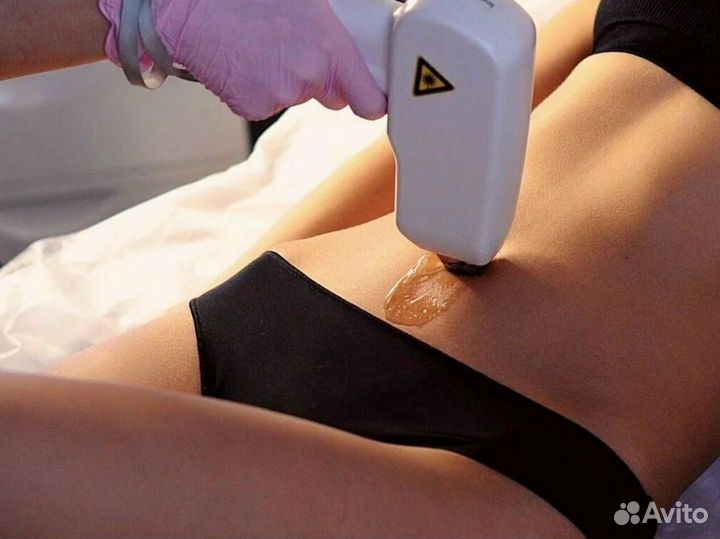 Готовый бизнес: лазерная эпиляция и SPA