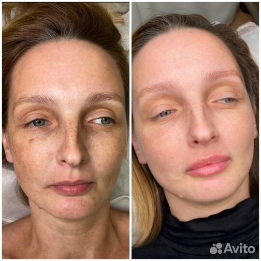 Обучение косметологов