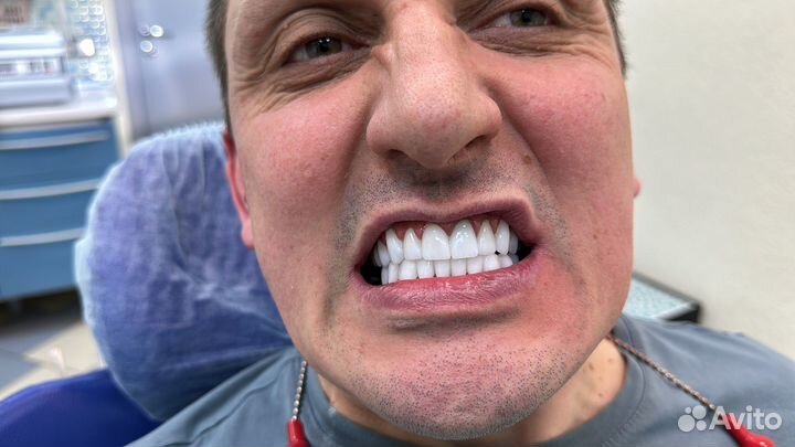 Стоматолог хирург имплантолог