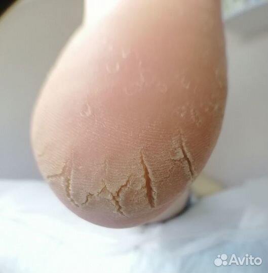 Маникюр, Смарт педикюр