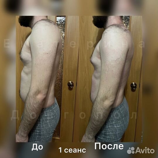 Массаж, Кинезиолог / Восстановление, Коррекция