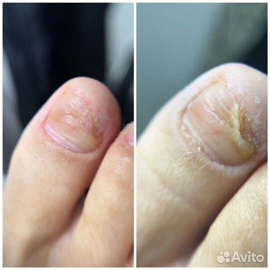 Мастер маникюра,педикюра,подолог