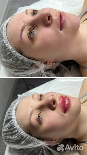 Косметолог Подольск Массаж Чистка лица Ботокс