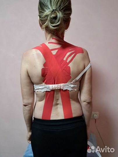 Кинезиотейпипование