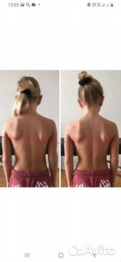 Массаж костоправ