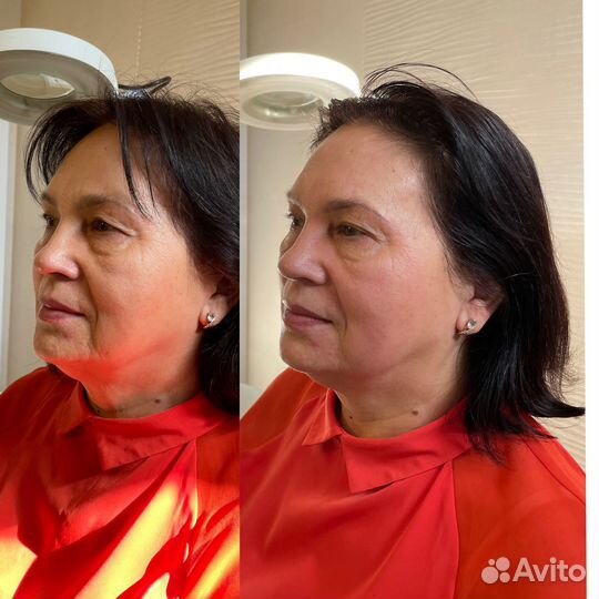 Массаж лица. Скульптурно-букальный,глубокотканный